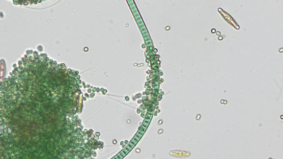 Figure 2 Observation au microscope de microalgues (diatomées, cyanobactéries) présentes dans les sources minérales naturelles radioactives