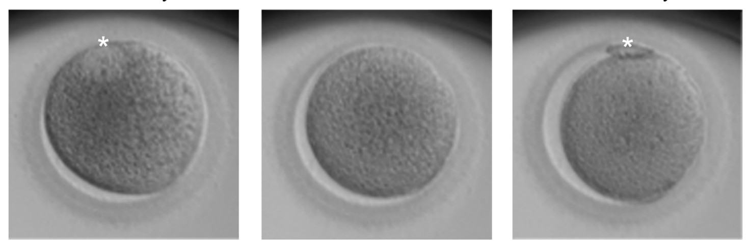 Maturation in vitro d'un ovocyte immature en ovocyte mature avec expulsion d'un globule polaire nécessaire pour être fécondé correctement par un spermatozoïde